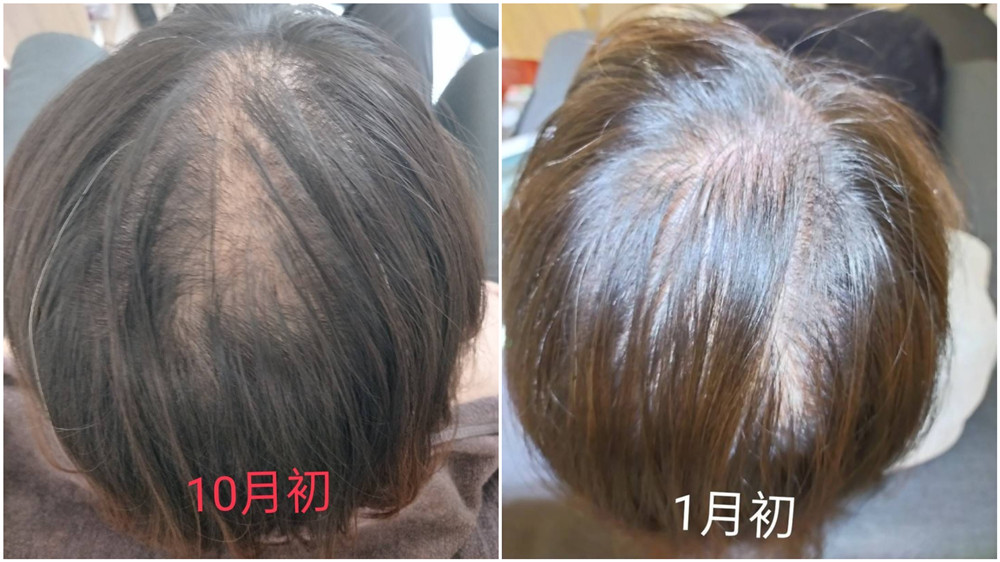 newSPA沙鹿店｜頭皮養護課程,改善髮量救星